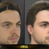 FIFA 15 Head Scan | Krul